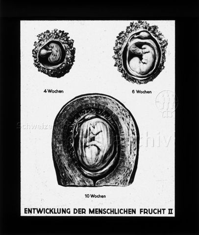 Diaserie zum Thema Schwangerschaft, Geburt, Entwicklung des Kindes und die weibliche Brust; "Entwicklung der menschlichen Frucht II" - Entwicklung des Embryos nach 3, 6 und 10 Wochen; um 1956