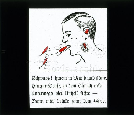 Diaserie zum Thema Kinderkrankheiten, Bazillen, Tuberkulose; "Schwups! Hinein in Mund und Nase, Hin zur Drüse, zu dem Ohr ich rase - Unterwegs viel Unheil stifte - Dann mich drücke samt dem Gifte" - Zeichnung: rote Strichmännchen (Bazillen) schlüpfen in Mund, Rachen und Ohr eines Mannes; um 1930
