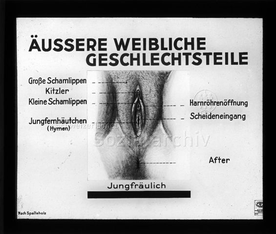 Diaserie zum Thema Schwangerschaft; "Äussere weibliche Geschlechtsteile" - Zeichnung mit Beschriftung der Geschlechtsteile; um 1930