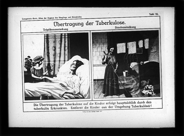 Diaserie zum Thema Säuglingspflege, Krankheiten; "Übertragung der Tuberkulose. - Die Übertragung der Tuberkulose auf die Kinder erfolgt hauptsächlich durch den tuberkulös Erkrankten. Entfernt die Kinder aus der Umgebung Tuberkulöser!" - "Tröpfchenansteckung" - Kind an Bett einer kranken Frau stehend; "Staubansteckung" - Frau am Boden wischen, kranker Mann in Bett liegend und Kleinkind auf Boden sitzend; "Langstein-Rott, Atlas der Hygiene des Säuglings und Kleinkindes"; um 1920