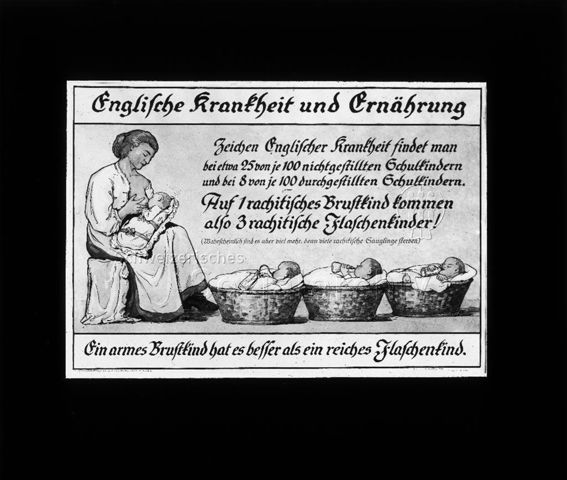 Diaserie zum Thema Säuglingspflege; "Englische Krankheit und Ernährung - Zeichen Englischer Krankheit findet man bei etwa 25 von je 100 nichtgestillten Schulkindern und bei 8 von je 100 durchgestillten Schulkindern! - Ein armes Brustkind hat es besser als ein reiches Flaschenkind"; Zeichnung einer Frau einem Kleinkind die Brust gebend, am Boden liegen drei Kleinkinder in Körben und trinken aus Flaschen; um 1930