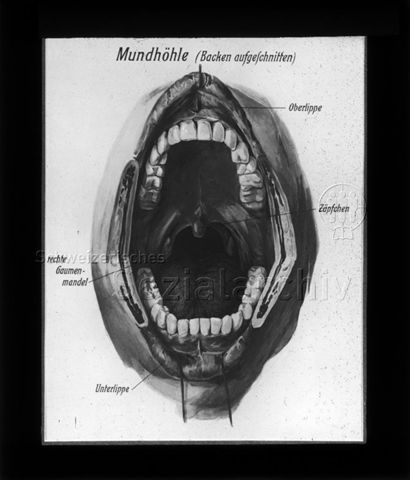 Diaserie zum Thema Kinderkrankheiten; "Mundhöhle (Backen aufgeschnitten)" - Zeichnung: geöffneter Mund mit eingezeichneter "Oberlippe", "Zäpfchen", "rechte Gaumenmandel" und "Unterlippe"; um 1930