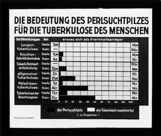 Diaserie zum Thema Tuberkulose im Kindesalter; "Die Bedeutung des Perlsuchtpilzes für die Tuberkulose des Menschen." - Diagramm zu Anteil der Erkankungen aufgrund des Perlsuchtpilzes oder des Tuberkelpilzes abhängig von der Art der Tuberkulose; Deutsches Hygiene-Museum; um 1930
