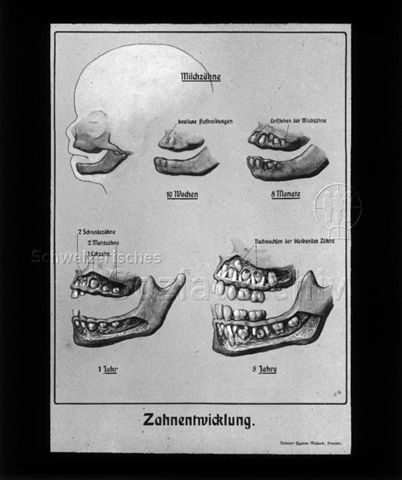 Diaserie zum Thema Säuglingspflege; "Zahnentwicklung"; Zeichnung zur Veranschauchlichung der Entwicklung der "Milchzähne" von 18 Wochen bis 5 Jahre; "National-Hygiene-Museum, Dresden"; um 1930