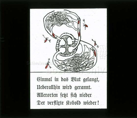 Diaserie zum Thema Kinderkrankheiten, Bazillen, Tuberkulose; "Einmal in das Blut gelangt, Ueberallhin wird gerannt. Allerorten setzt sich nieder Der verflixte Kobold wieder!" - Zeichnung: Herz mit Blutbahnen mit roten Strichmännchen (Bazillen); um 1930